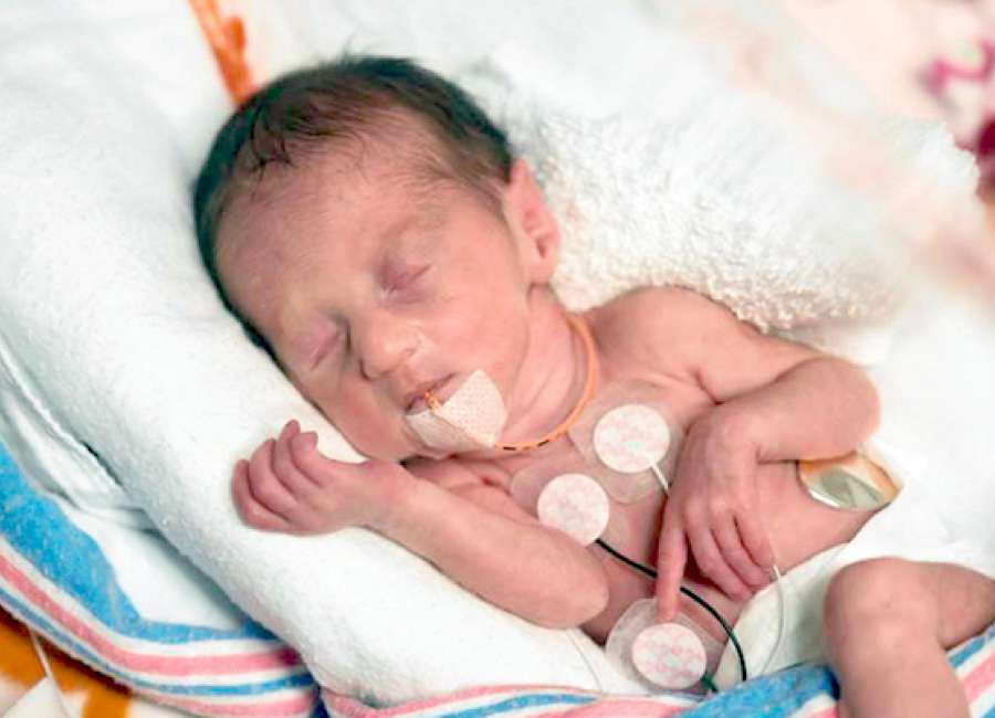 Newborn quadruplets continue to thrive at Piedmont